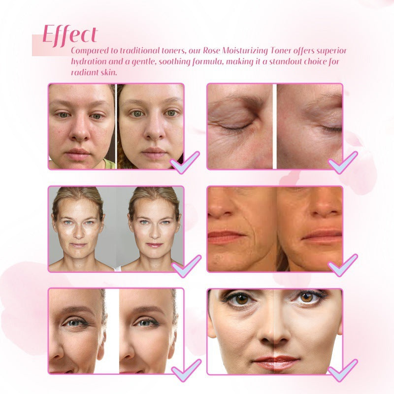 Découvrez notre Tonique Facial Rose Hoygi : L'Équilibre Parfait pour Votre Peau !